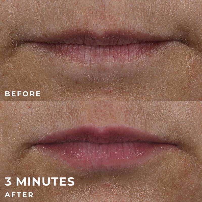 [RoC Skincare] DERM CORREXION Lip Volumizer