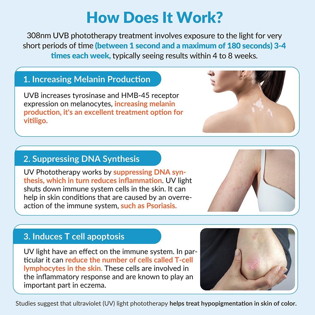 ZJZK 6 Diodes 308nm UVB Excimer Phototherapy Device, 20mW/cm² High Energy Density, Handheld Blue Light Skin Treatment, Targeted Therapy for Vitiligo, Psoriasis, Eczema, Atopic Dermatitis, Portable Home Use for Skin Disorders