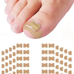 100pcs Ingrown Toenail Correction Pads, Professional Pedicure Tool, Unisex Nail Care, Toe Nail Trimming Stickers, Designed for Nails, Nail Care Patches