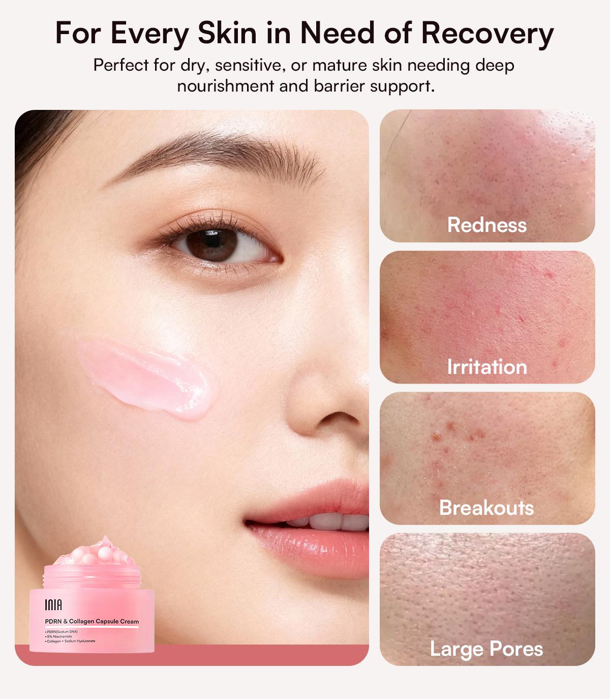 【LIVE EXCLUSIVE】INIA PDRN + Peptide Repair Bundle – Cream & Serum Duo for Deep Repair & Radiant, Firmly Hydrated Skin with Salmon DNA, Peptides & Niacinamide, Safe for Sensitive Skin