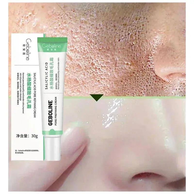Pore Minimizing Salicylic Acid Face Cream - Korean Skincare Treatment for Skin Tightening, Smooths Skin