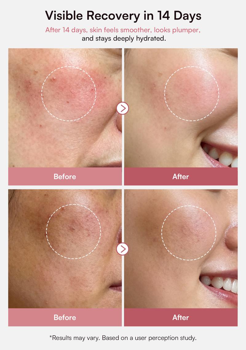 INIA PDRN + Peptide Repair Bundle – Cream & Serum Duo for Deep Repair & Radiant, Firmly Hydrated Skin with Salmon DNA, Peptides & Niacinamide, Safe for Sensitive Skin