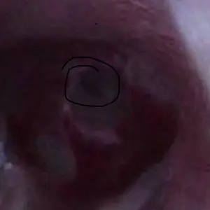 Smart 1080P HD Ear Camera Kit 9 Piece Set for iPhone & Androidh 6-9 Soft Silicone Spoons Rechargeable Battery Black Safe Wax Removal Tool with Crystal Clear View