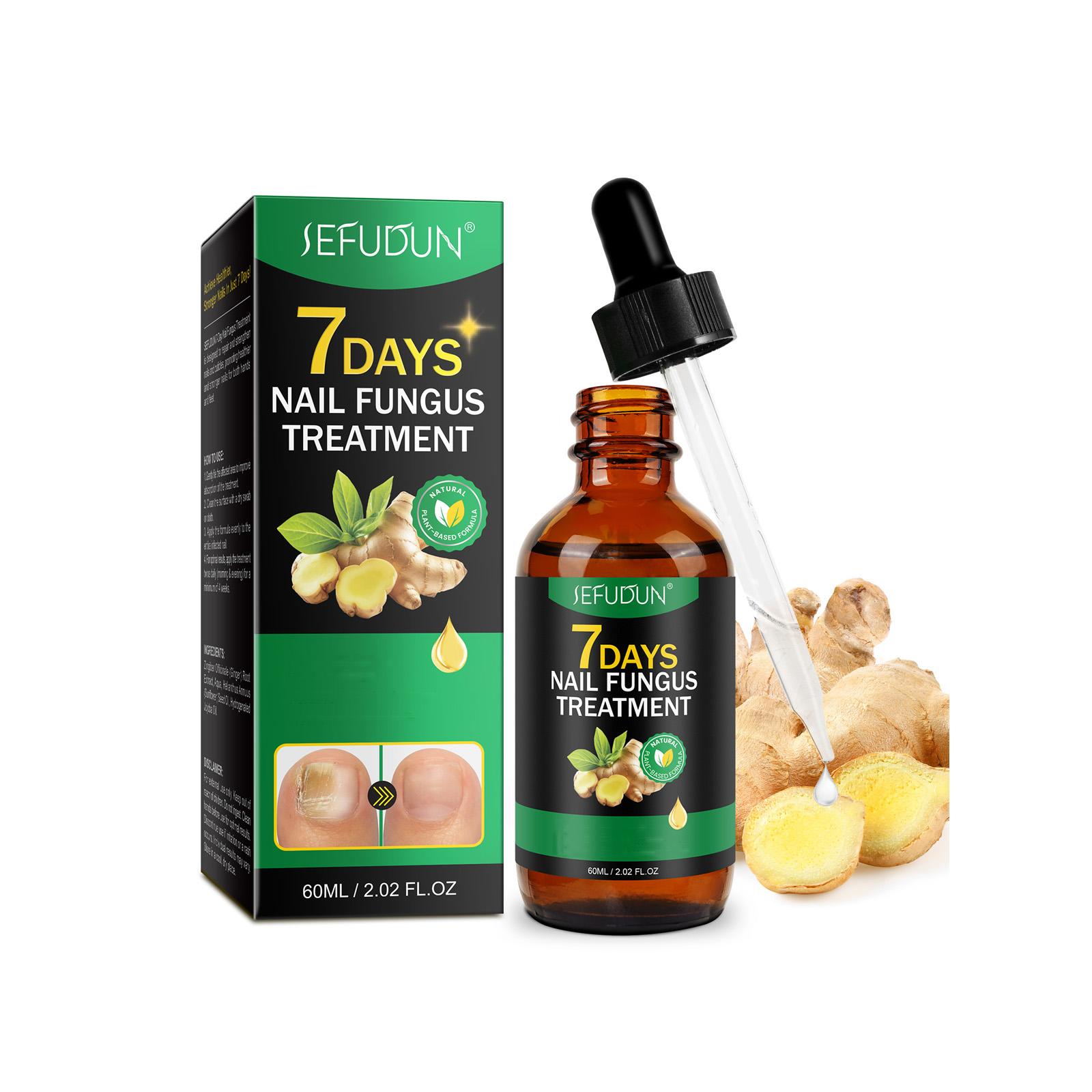 Sefudun Ginger Cuticle Nourish Nail Nutrient Oil - 60ml Unisex Adults' Nail Care Essence with Jojoba & Botanical Extracts for Deep Hydration & Repair