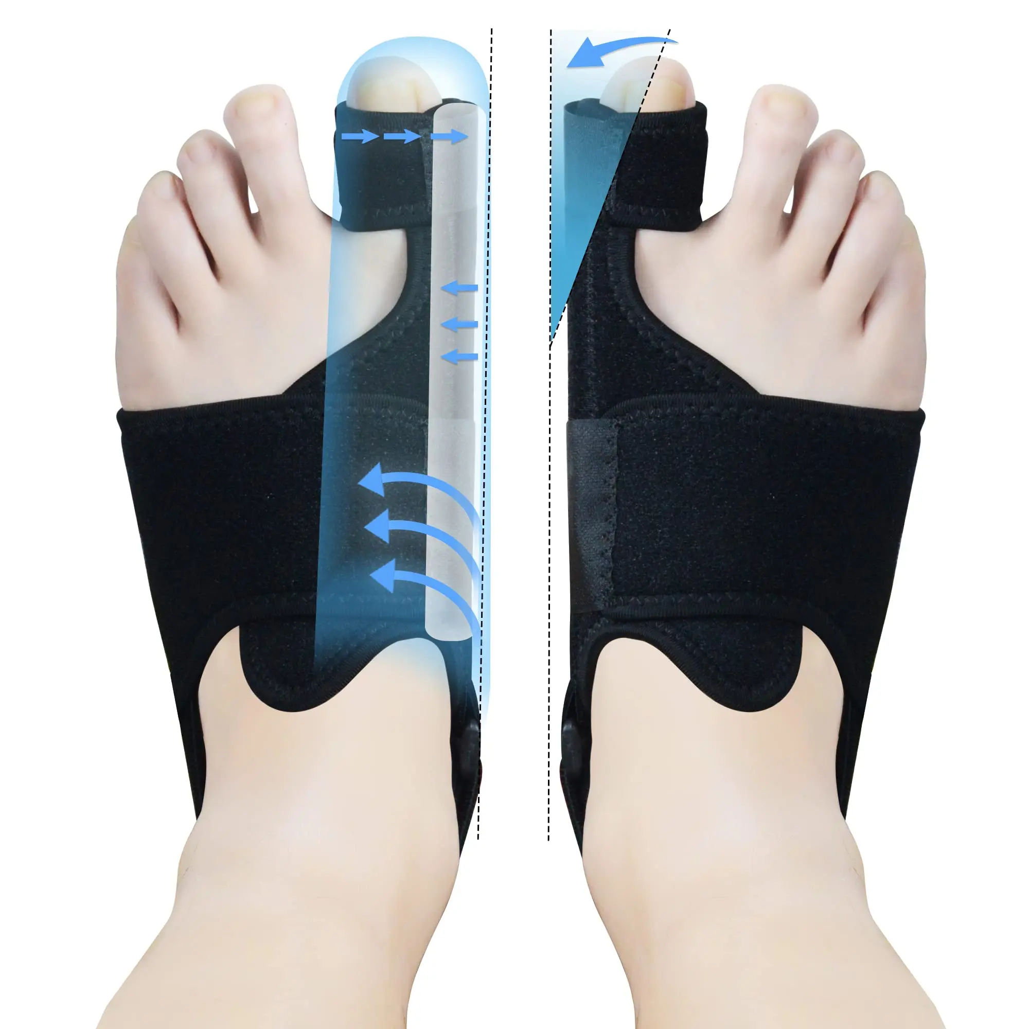 1 pair Thumb Corrector for Pain Relief Bunion Corrector for Women Men Adjustable Toe Splint Big Toe Brace Bunions Relief Kit Day Night Support Toe Separator Hallux Valgus Treatment Foot Care Solution black