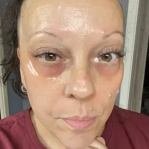 Mature skin results