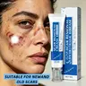 Scar Cream Face Body Improves Acne & Surgical Scars, Moisturizing Scarring Aid for Old & New Marks, Lightweight Non-Greasy Formula, Gentle Daily Use 30g for Adults
