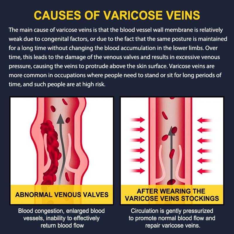 3 Pairs Calf Compression Sleeves 15-20mmHg – Leg Support for Men and Women, Shin Splints Relief, Running and Sports Training, Knee & Calf Protection