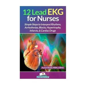 12 Lead EKG for Nurses: Simple Steps to Interpret Rhythms, Arrhythmias, Blocks, Hypertrophy, Infarcts, & Cardiac Drugs