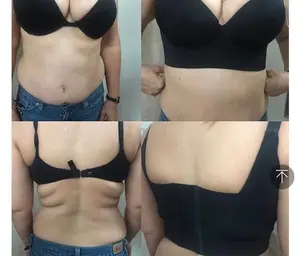 Back Fat Super Bra