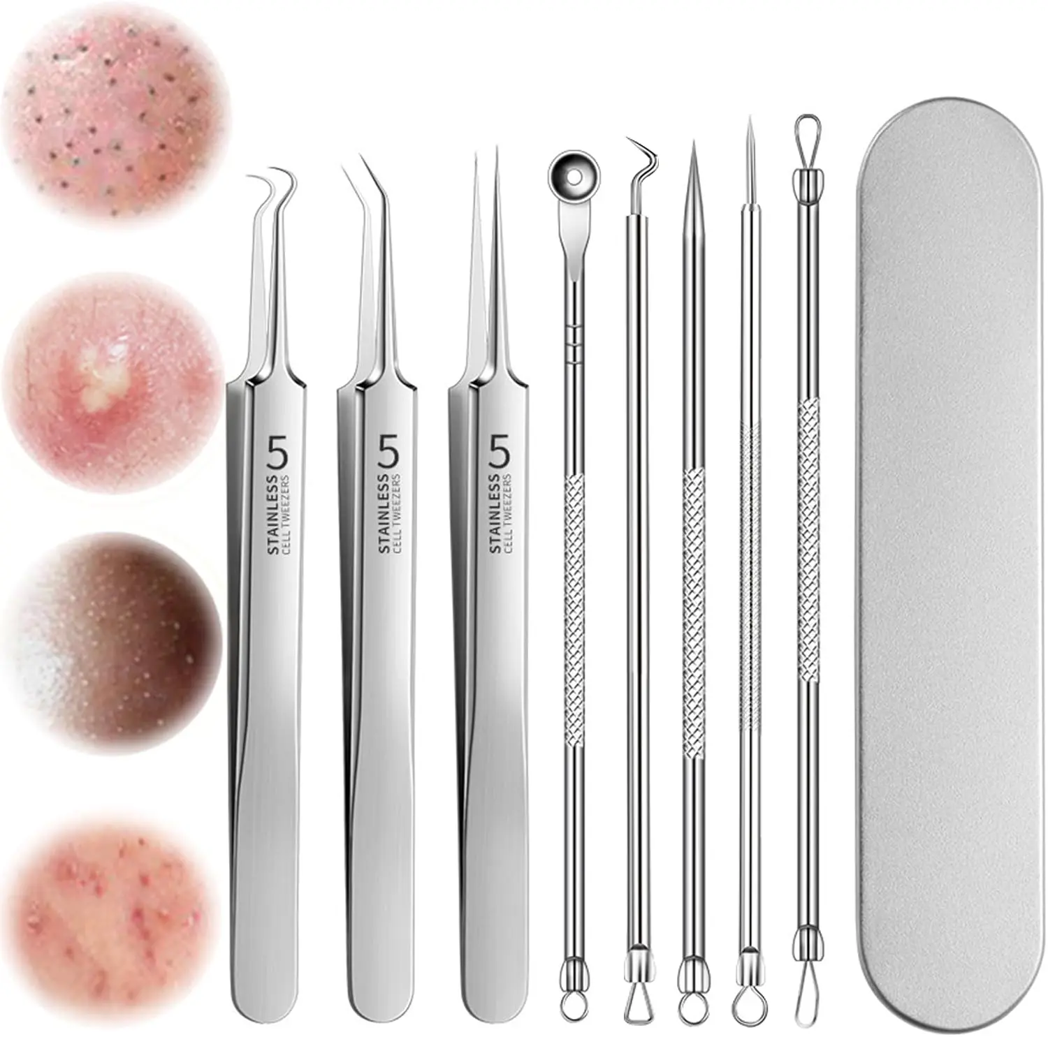 8PCS Multi-Pack Blackhead Remover Comedone Extractor Tools - Blackhead Removal, Hygienic Facial Skincare Tools for Estheticians, Safe for Sensitive Skin, Easy to Sanitize