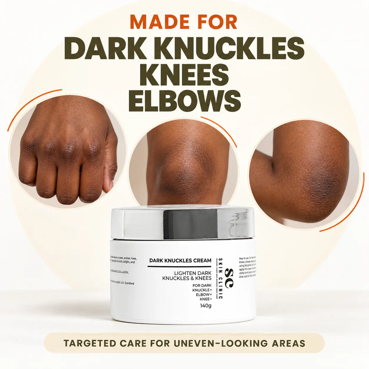 [Skin Clinic] Dark Knuckles Cream – Dark Knuckles Elbows Underarms Dullness & Skin Moisturizing - For Women & Men