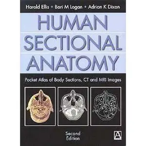 USED-Human Sectional Anatomy: Pocket Atlas of Body Sections, CT and MRI Images (An Arnold Publication) by Adrian Dixon (Paperback)