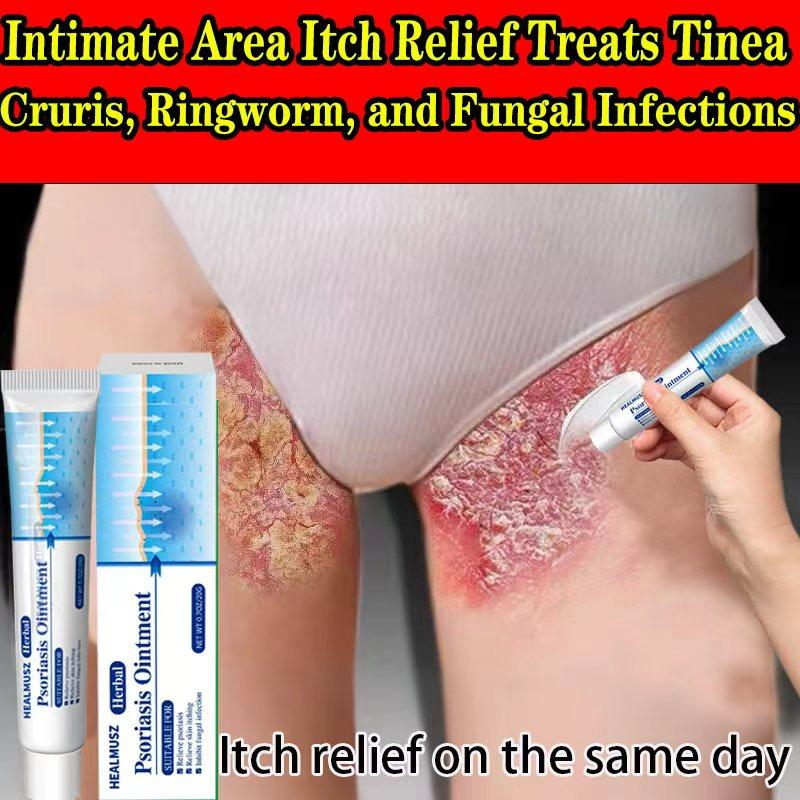 Maximum Strength Anti-Fungal Cream – Targets Psoriasis, Ringworm, Athlete’s Foot, Tinea, Eczema – 100% Plant-Based & Steroid-Free – Soothes Itch, Repairs Dry Skin, Prevents Flare-Ups