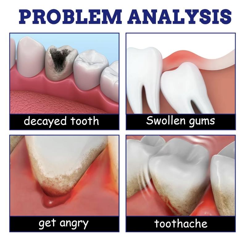 Oral Care Spray - Quick-acting Toothache Relief, Prevents Tooth Decay, Reduces Gum Swelling, Gentle Daily