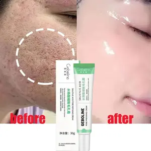 Salicylic Acid Pore Shrinking Cream Tighten Face Smooth Skin Korean Care Product Salicylic Acid Pore Shrinking Cream Tighten Face Smooth Skin Korean Care Product