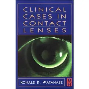 USED-Clinical Case in Contact Lenses by Ronald K. Watanabe OD  FAAO (Paperback)