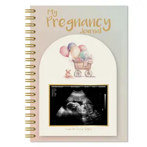 82pages Pregnancy Journal Memory Book,pregnancy announcement kay,Pregnancy Book for Gift,Pregnancy Journals for New Moms,Pregnancy Announcements with Sonogram Photo, Mom Book Diary,Through Third Trimester Milestone Tracker