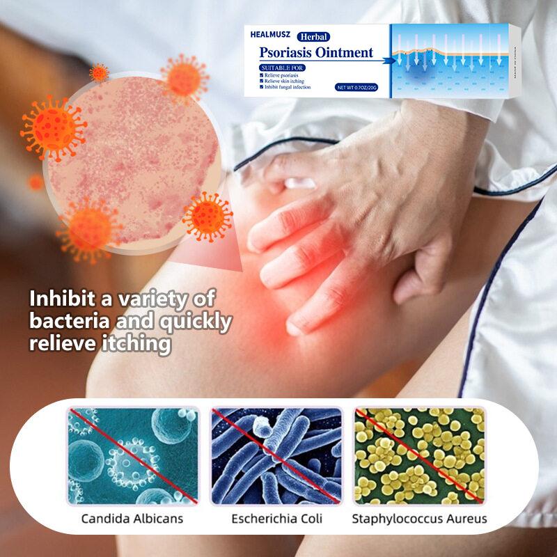 Extra Strength Psoriasis & Antifungal Cream 100% Natural Plant Extracts Fast Acting Relief for Itchy Red Dry Skin Fights Psoriasis Tinea Athlete's Foot Ringworm Deep Skin Repair Non-Recurring Safe for All Skin Types 20g Tube