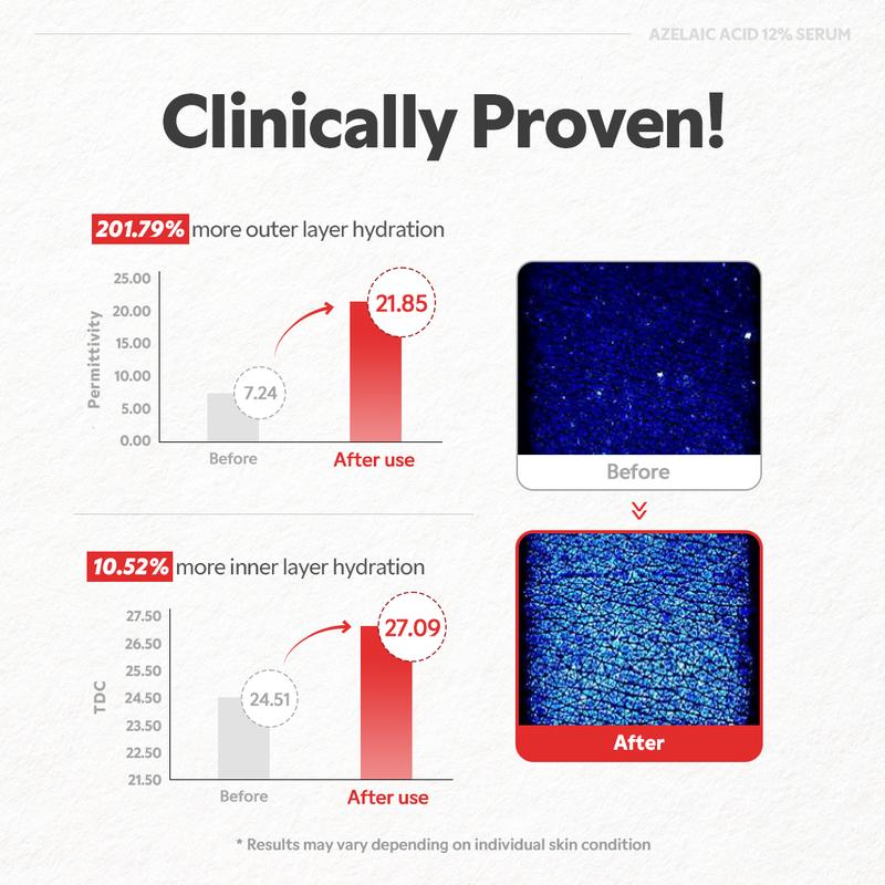 [TIRTIR Official] Azelaic Acid 12% Serum - Lightweight Dark Spot Reducer, Gentle Breakout care, For Uneven skin tone, Redness, Red Marks and Acne