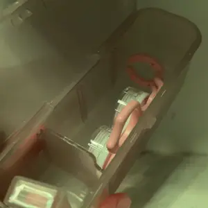 Contact Lenses Applicator Tool,Contact Lens Applicator,Contact Remover Tool for Soft Contacts Insertion Tool Set Includes Tweezers,Contact Lens Case and Contact Lens Remover Plunger Suction Cup