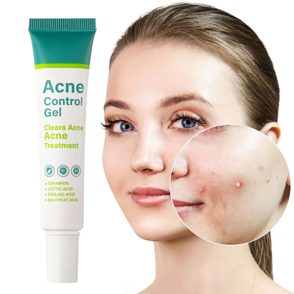 【FDA】Acne gel, spot treatment, 2% salicylic acid serum  acne c  Salicylic Acid Pore Minimizing Cream