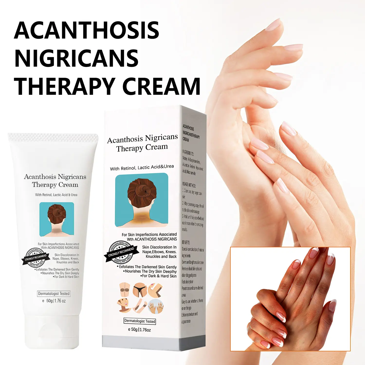 Dermatologist-Tested Acanthosis Nigricans Cream with Retinol & Lactic Acid, Exfoliating Body Moisturizer for Dark Neck, Ankles, Armpits & Elbows, 50g, Body Care, Moisturizers