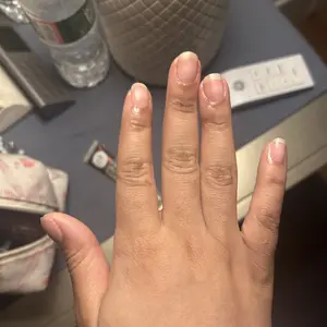 Product Review of Radiant Cosmetics Nail Growth Oil - 100% Organic, Moisturizing, Growth, Strengthening, and Brightening Formula with Vitamins and Fatty Acids for Overall Nail Health from I**️