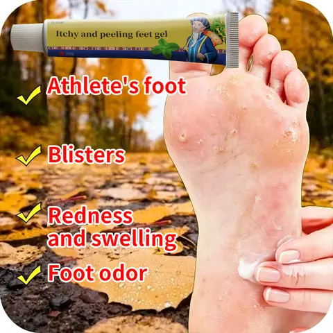 Foot Cream Gel for Fungal Infection Relief - Soothing Foot Care Deodorant, Anti-Itch & Anti-Odor, Reduces Sweat, Softening Foamy Treatment for Cracked Heels & Desquamation, 20g Single Item