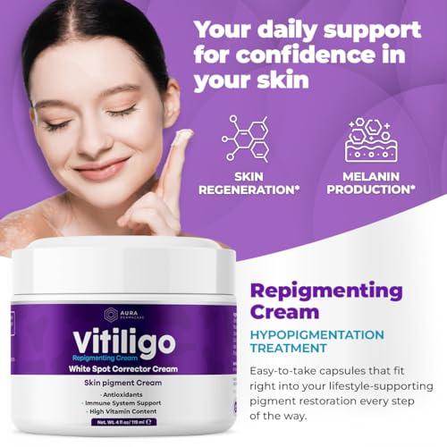 Vitiligo Cream for White Spots (4oz) - Repigmenting Cream with Polypodium Leucotomos and Melanocyte Support - Evens Skin Tone and Reduces Discoloration by Aura Dermacare
