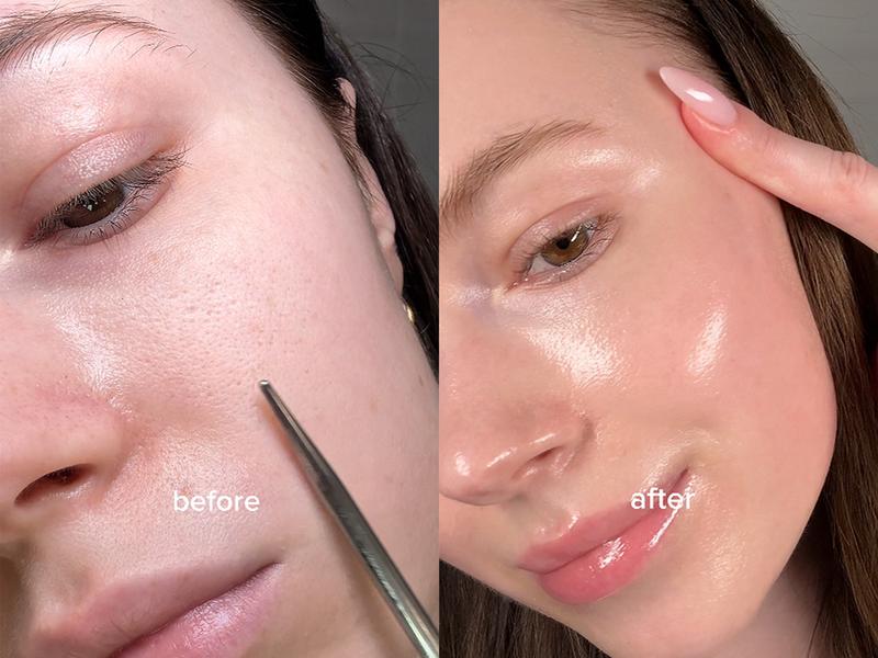 [FRANKLY] PDRN Bounce Ball Serum | Salmon DNA, Salmon Sperm | Glow Skin, Plumping Effect, Korean Skincare, Lightweight