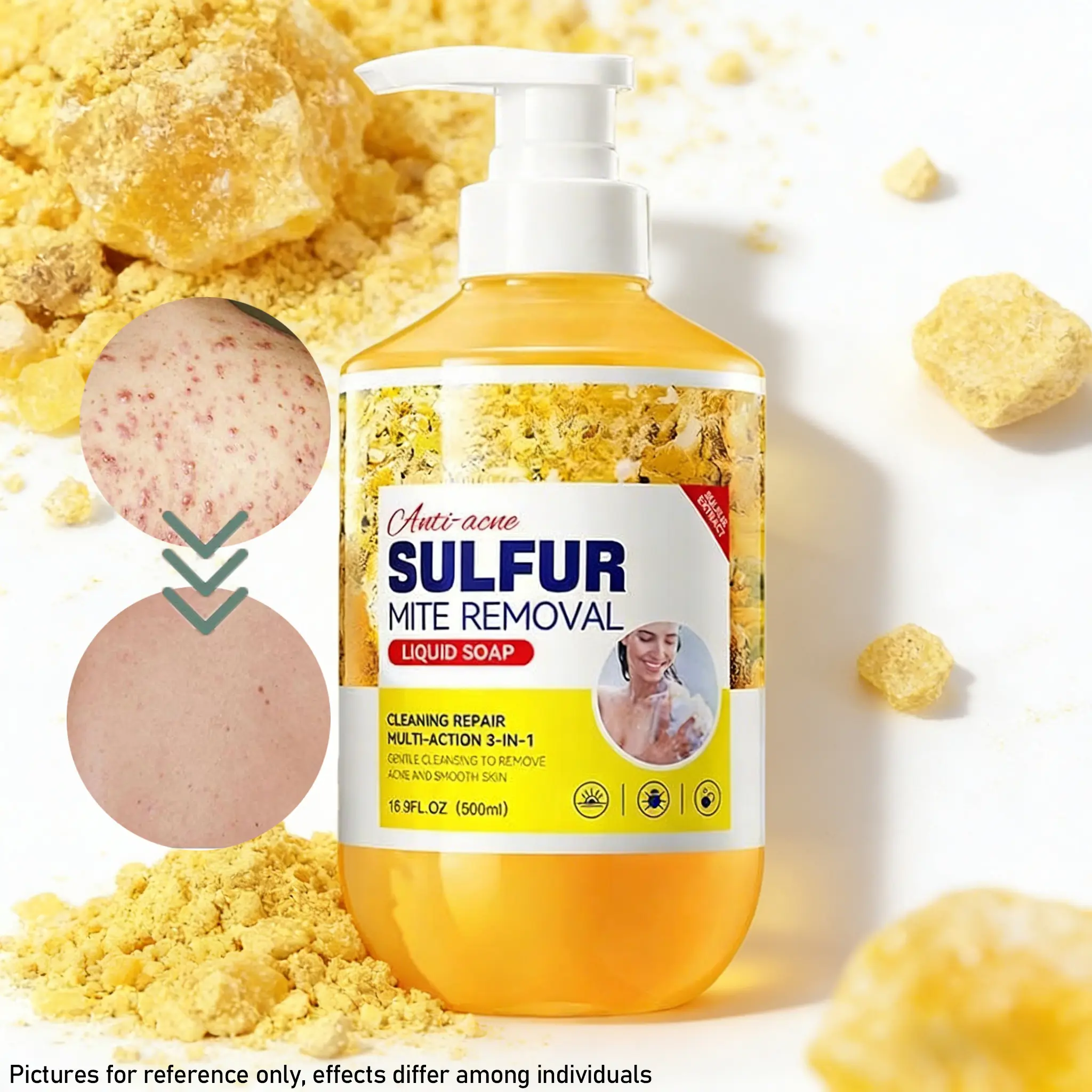 Sulfur Anti-Mite and Antibacterial Body Wash - 18 oz - All-natural antifungal and anti-mite bath gel, suitable for back acne, exfoliation, cleansing and moisturizing, healthy skin, refreshing fragrance, unlimited charm, suitable for both men and women