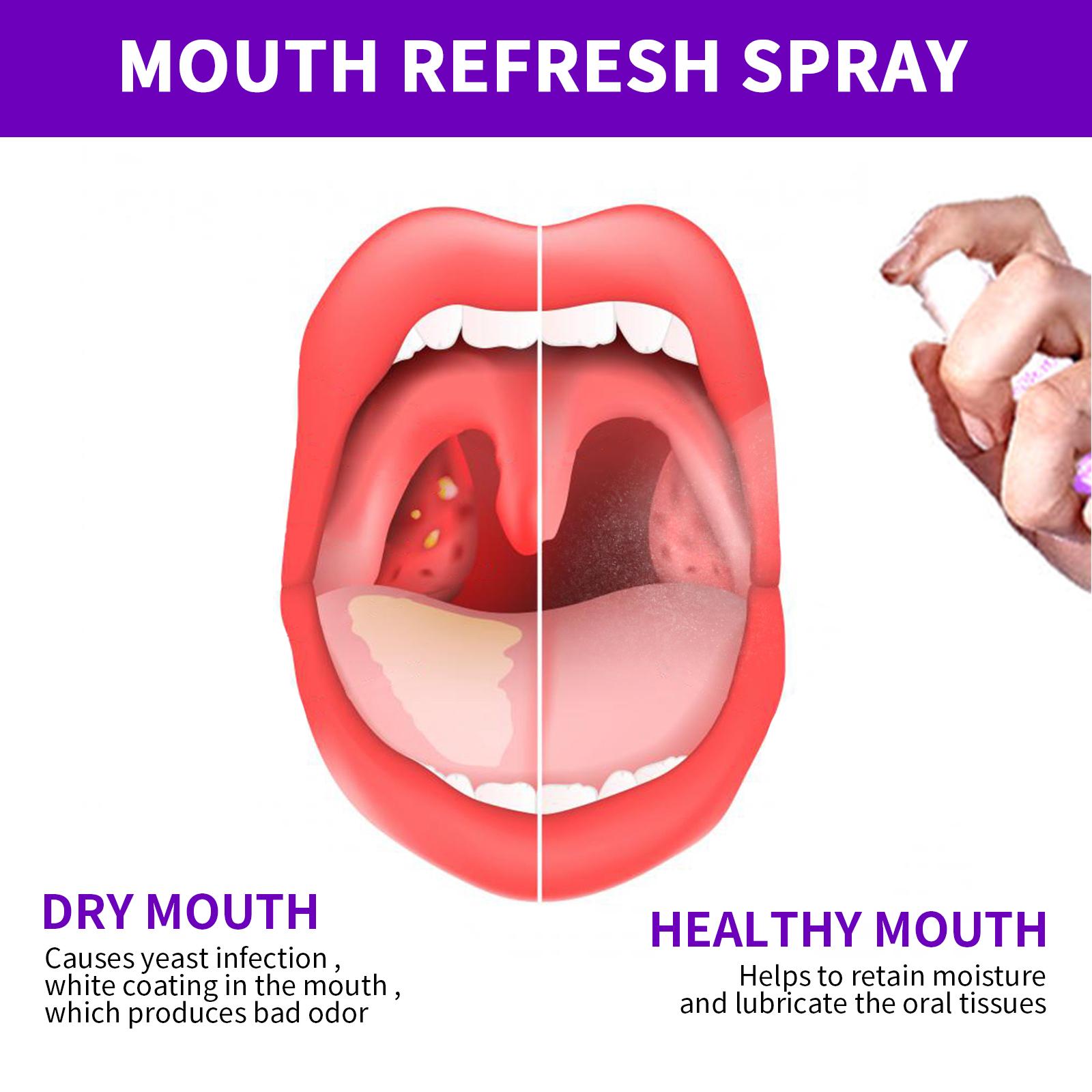 20ml Mouth Refresh Spray, Oral Probiotic Breath Spray, Natural Fresh Spray for Men and Women, Fresh
