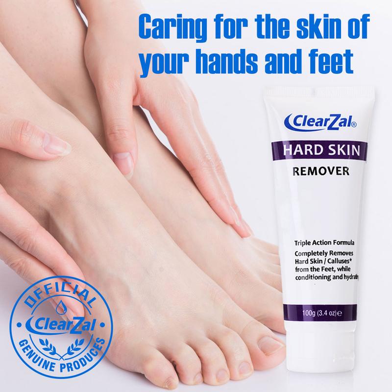 Clearzal  Dry Cracked Feet Repair UltraHydrating Hand and Foot Cream Crusty Moisturizer, 3.5 oz. Contains Urea, Salicylic Acid, for Dry, Chapped, Cracked Feet, Dead Skin Remover, For Thick, Cracked, Rough Skin , dead skin and dry skin cream