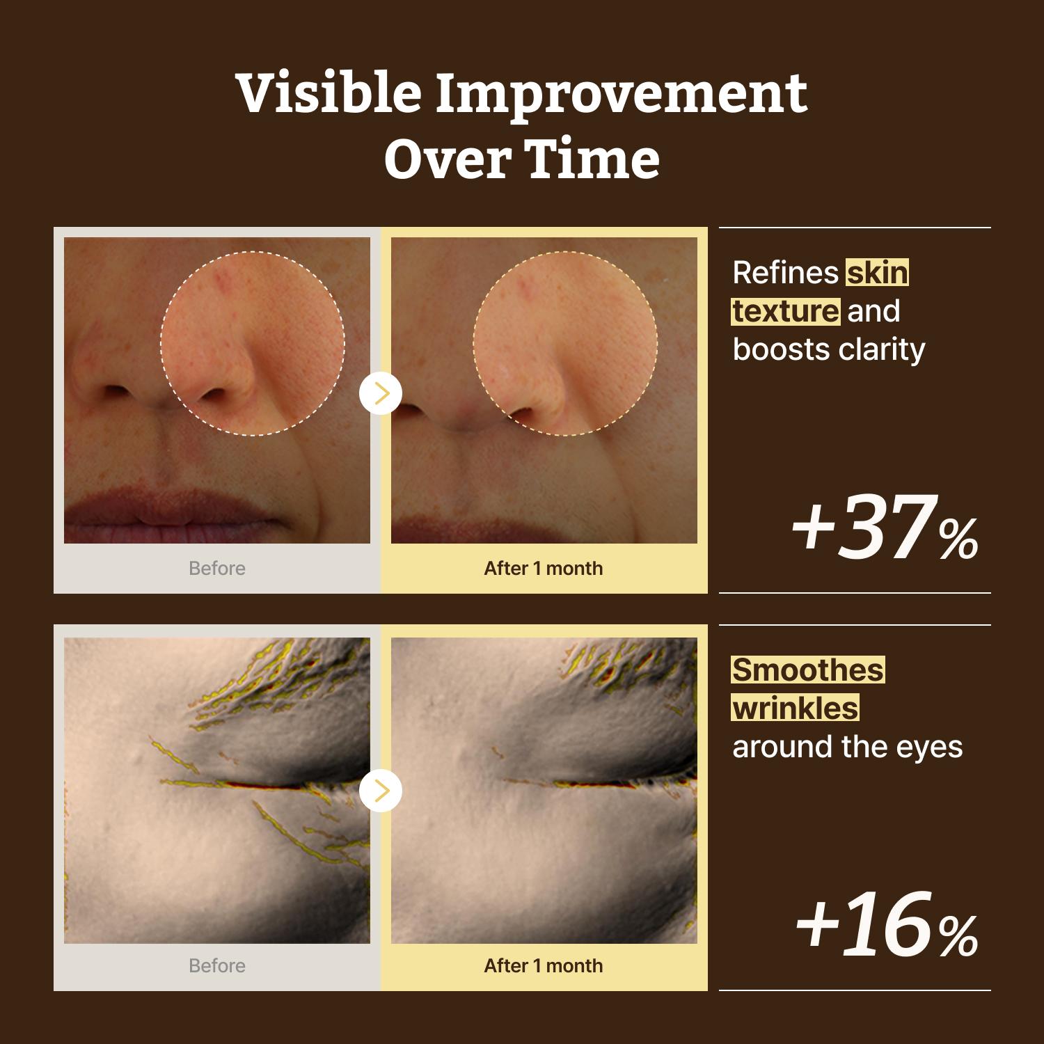 Dr.Reju-All Advanced Retino-Mela Serum – HPR Retinol Serum for Face – Anti-Aging, Pore Minimizer, Next-Gen Korean Skin care – Gentle & Beginner-Friendly – Niacinamide 10% & TXA 4% – 1 Fl Oz