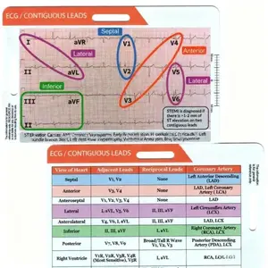 Electrocardiogram/ECG Rhythm Pocket Card Double sided ECG Rhythm Interpretation Badge Card ECG Rate Pocket Card Nurse ECG Card Guide Nurse ECG Technology Student Rapid Cardiac Analysis and Measurement Tool