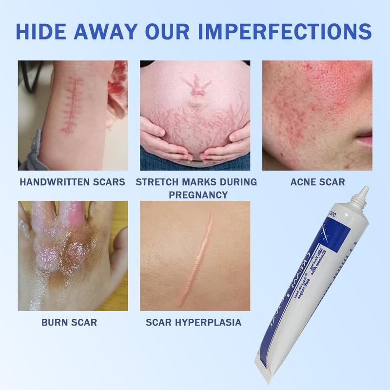 Scar Cream,Silicone Scar Gel,Scar Removal Cream,Scar Silicone Gel,Scar Gel,Scar Cream for Surgical Scars and Keloid Bump