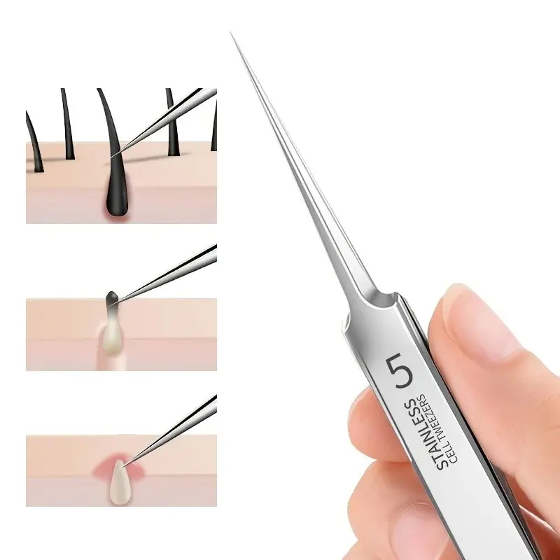 Blackhead Removal Tweezers Stainless Steel Tools - Effective Comedones Extractor, Whiteheads Removal Deep Cleansing Tools, Pore Tweezer Tools, Facial Care Tools, Beauty Tools