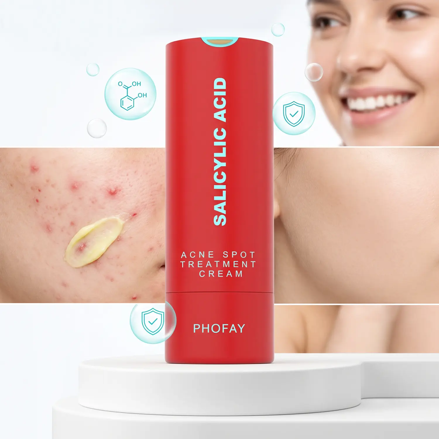 Acne Cream Acne Treatment Pimples Removal Cream Pair Acne Gentle Antibacterial Blemishes Skin Repair, Daily Skincare With 1.08% Salicylic Acid, Revitalize Skin Vitality Help Makeup Stick Better