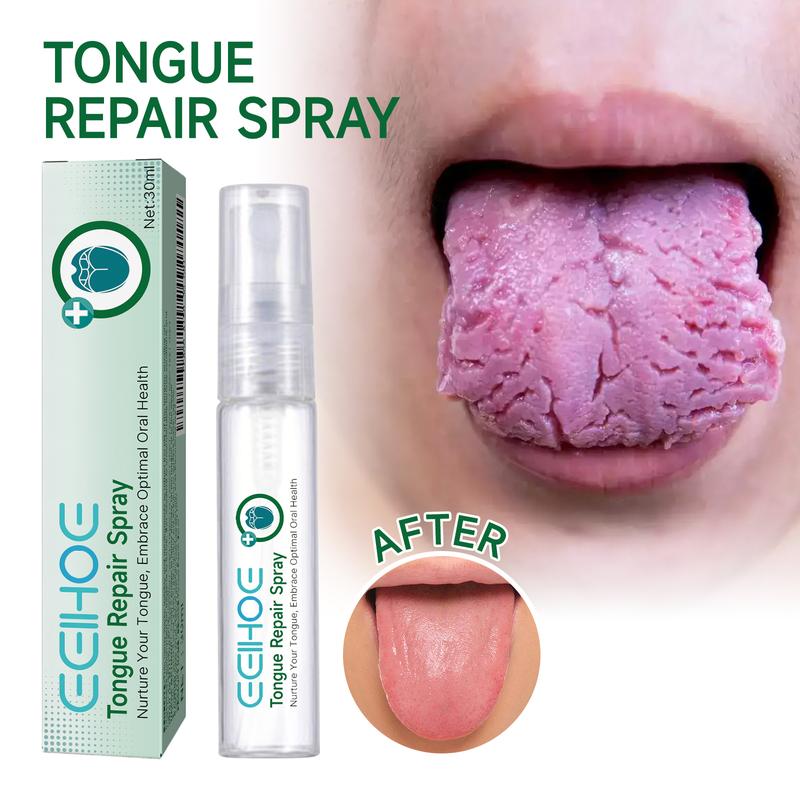 Tongue Repair Spray - Soothes White Coating, Relieves Dryness & Swelling - Oral Care Solution for Healthy Tongue & Fresh Breath