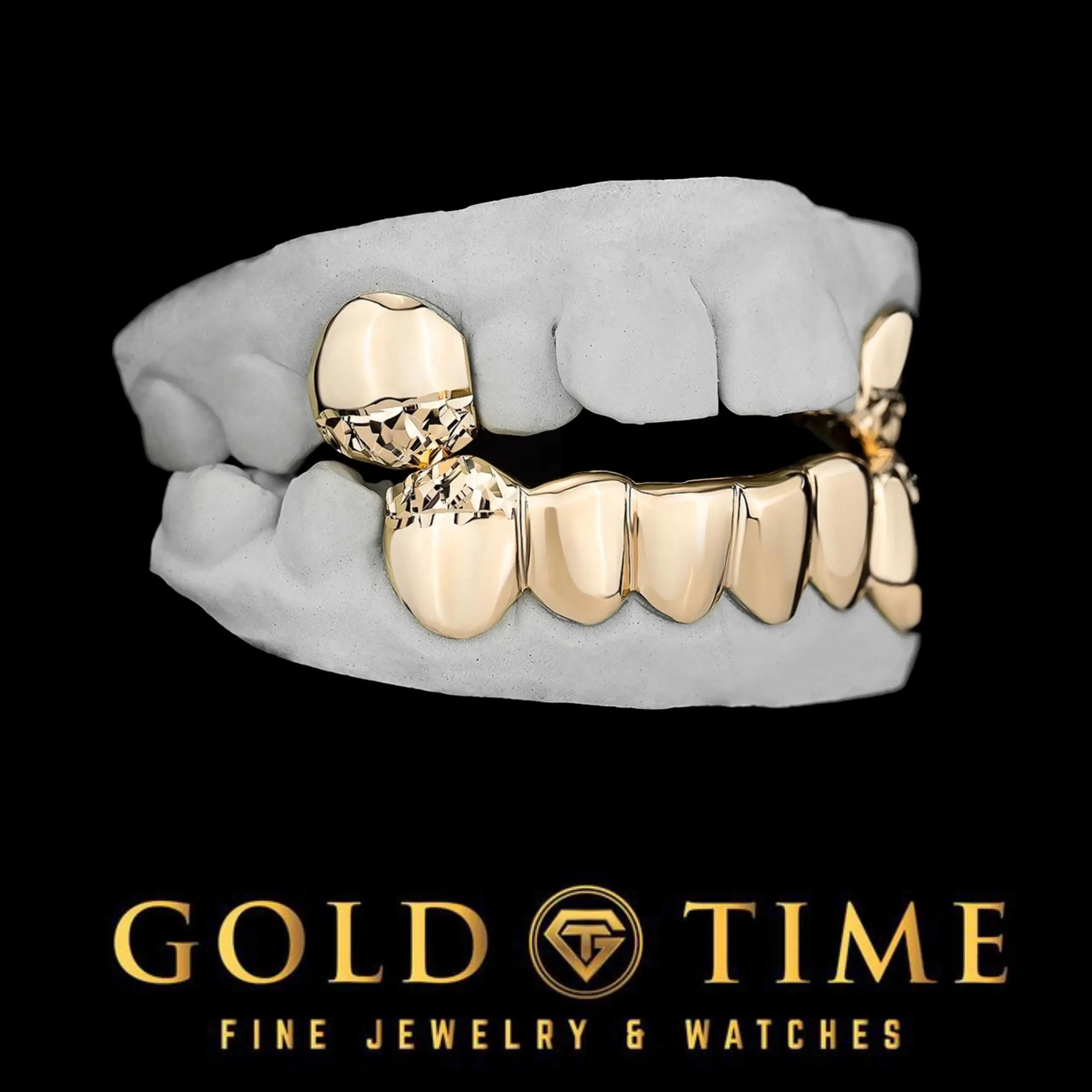 Custom 8 Piece Grillz Set – Trillion Diamond-Cut Tips