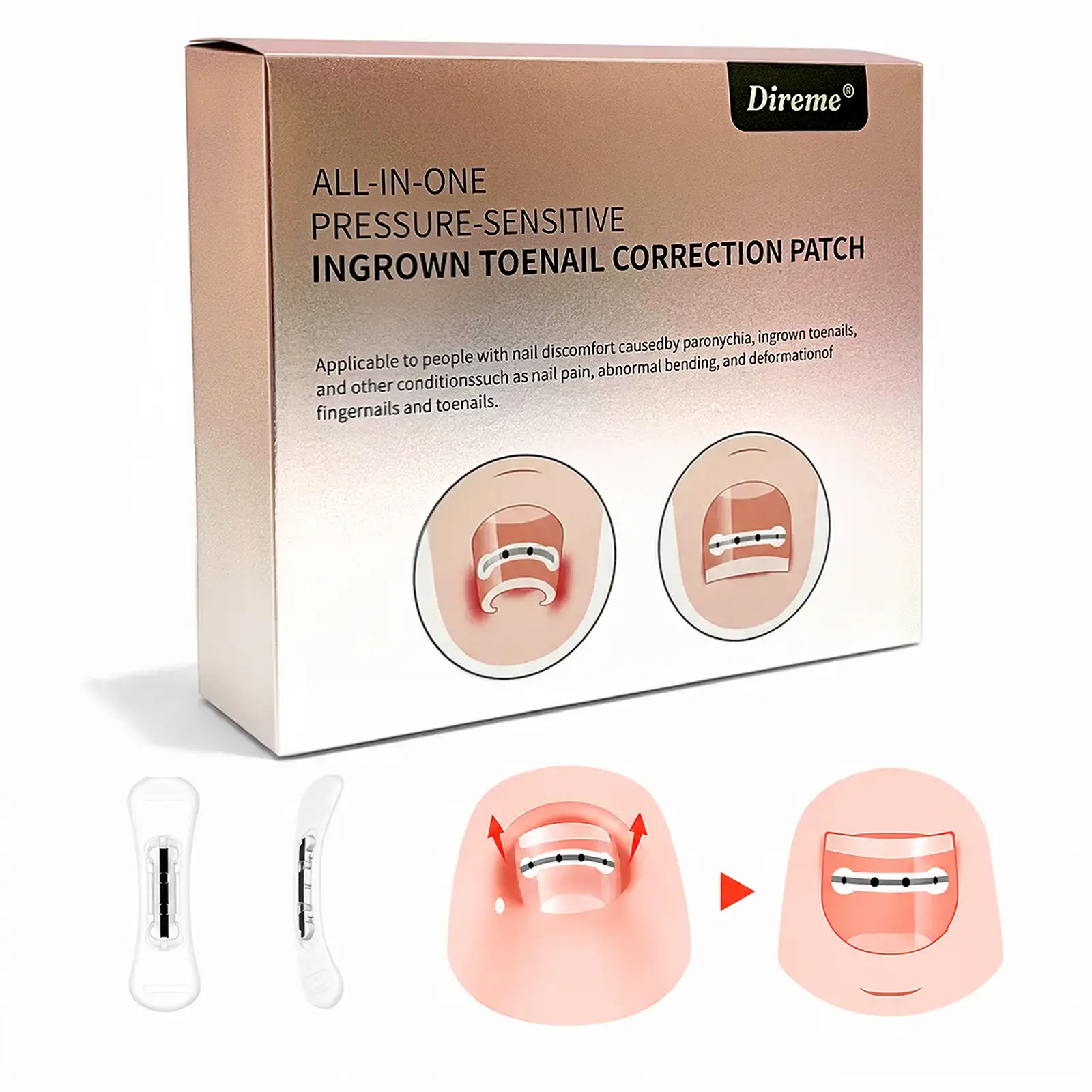New Upgrade ,Ingrown Toenail Lifter, Ingrown Toenail Remove Kit,  Painless Ingrown Toenail Corrector  Patch, Quick repair Ingrown Nail Treatment Tool , Nail Care Home  Silicone Titanium Manicure Toe Separators Home Spa Equipment