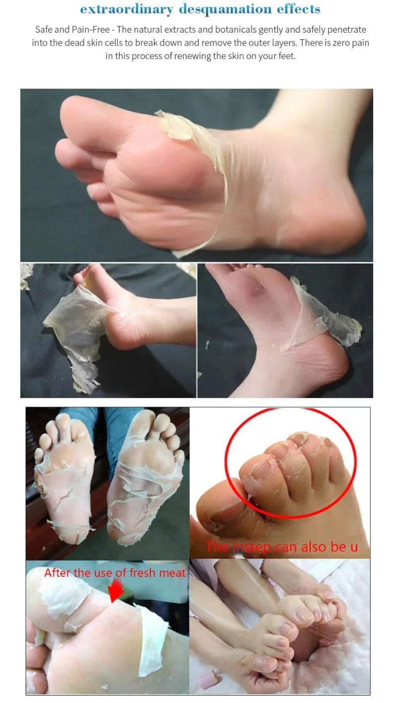 Exfoliating Foot Mask Pedicure Socks Dead Skin Remover for Heels Feet Peeling Callus Softening Smoothing Hydrating Botanical Extract Nourishing Foot Care Treatment Routine Unisex