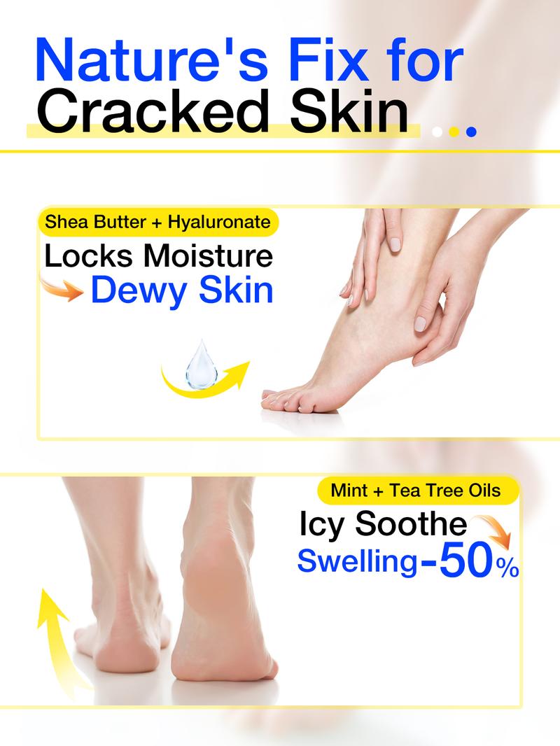 Aavini Intense Foot Cream - Repairs Cracked Skin, Antibacterial and Deodorizing, Removes and Softens Calluses, For All Skin Types, Moisturizing Foot Lotion