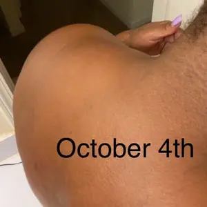 Lemon Turmeric KojicAcid Soap, Turmeric & Kojic Acid Brightening Soap, DarkSpot Remover, Kojic Acid Soap, Soap Body CareBody Wash Lemon Flawless Organic