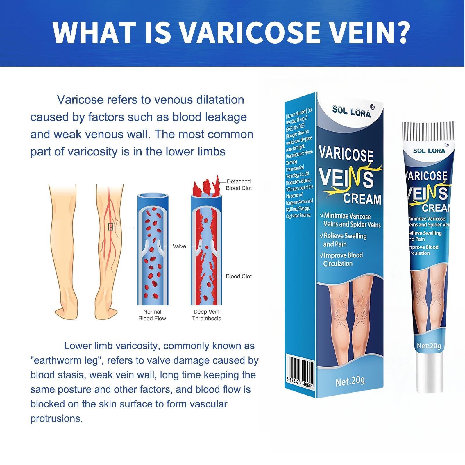 SOL LORA Varicose Veins Cream for Varicose Veins Relief of Bulging Blood Vessels in Legs - Hydrating Moisturizer for Smoother Skin & Improved Circulation