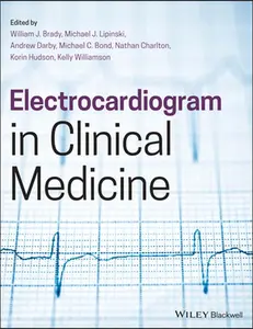 USED-Electrocardiogram in Clinical Medicine (Paperback)