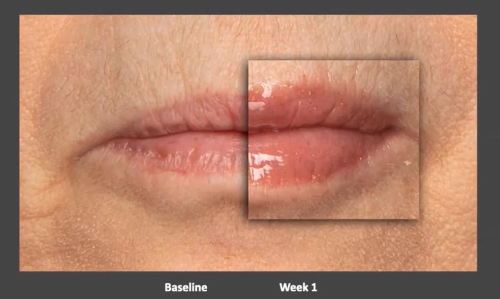 Nu Colour Peptide Pout Lip Plumping Gloss - Makeup Cosmetic Waterproof Volume