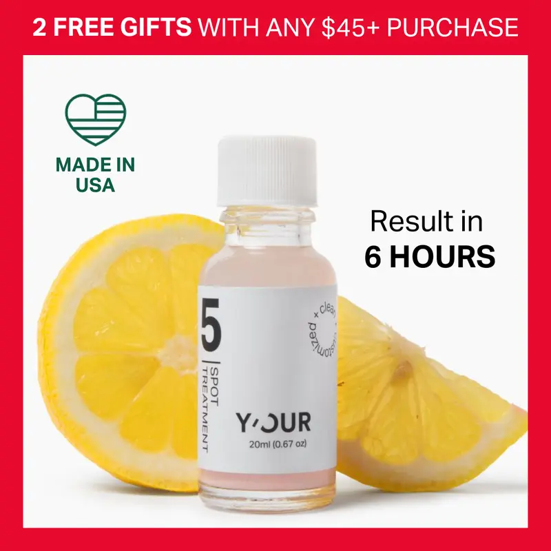 Acne Drying Spot Treatment by Y'OUR, with Salicylic Acid & Bentonite Clay for Sensitive Skin 20ml Fast Acting Potent Pimple Remover, Made in USA. Valentine gift for her