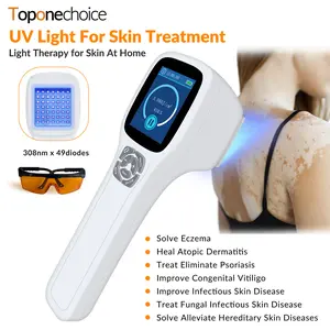 Toponechoice  308nm Excimer Phototherapy Device with 49 Diodes, Blue Light Therapy for Vitiligo, Psoriasis, Eczema, Atopic Dermatitis, Fungal Skin Disease, Hypopigmentation, Safe Targeted Home Use, Fast Recovery, Prevent Recurrence, Portable Handheld